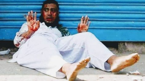 পুলিশের গুলিতে গুরুতর আহত একজন বিক্ষোভকারি